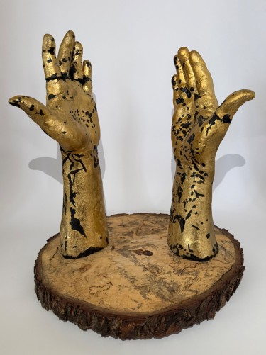 VITILIGO, autor KrisBoginja